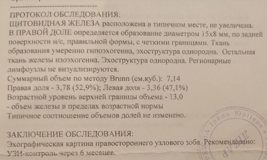 узд щитоподібної залози