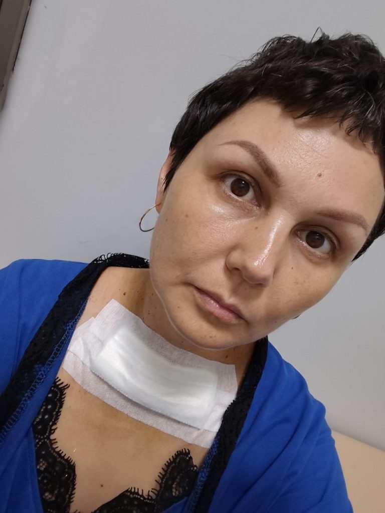 операція на щитоподібній залозі: наступний день
